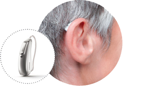 OHRpheus Ratgeber Hören Hörgeräte-Bauformen Hinter dem Ohr HdO